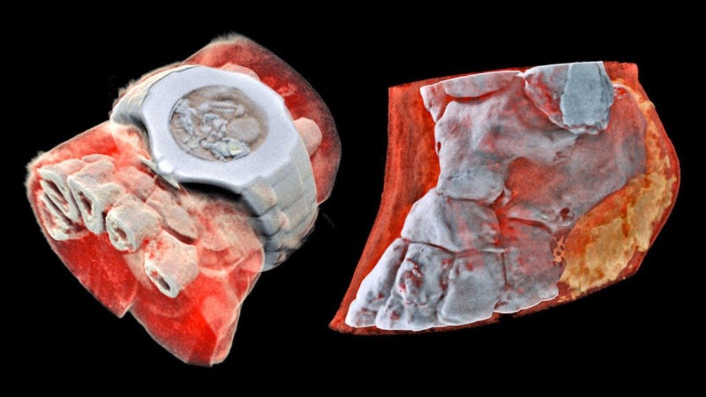 3D Color X-Rays